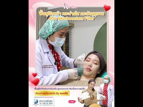 รีวิวหัตถการโปรแกรม Filler Skin Booster
