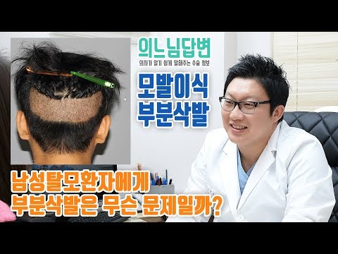 의느님답변????ㅣ남성탈모환자에게 부분삭발은 무슨문제일까?