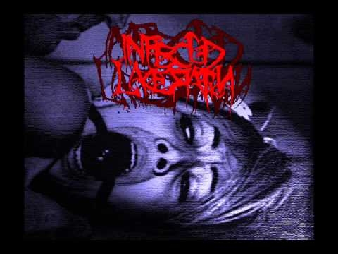 Infected Laceration - Cock Meat Sandwich