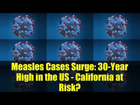 Measles Outbreak Alert: U.S. Faces 33-Year High - Vaccination Crisis Explained