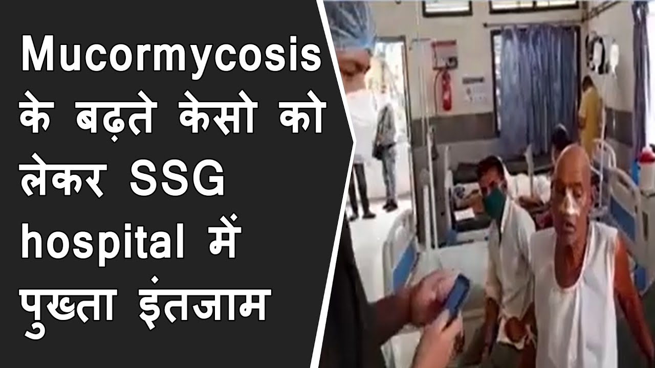 Mucormycosis के बढ़ते केसो को लेकर SSG hospital में पुख्ता इंतजाम BRG NEWS