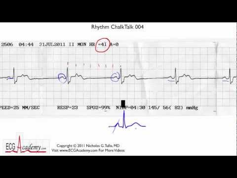 ECG Interpretation, Intermediate Level - Part 4