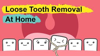 How To Pull Out A Loose Tooth At Home