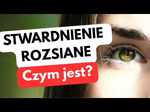 Stwardnienie rozsiane – choroba, która uczy siły | Objawy, leczenie i nadzieja na przyszłość