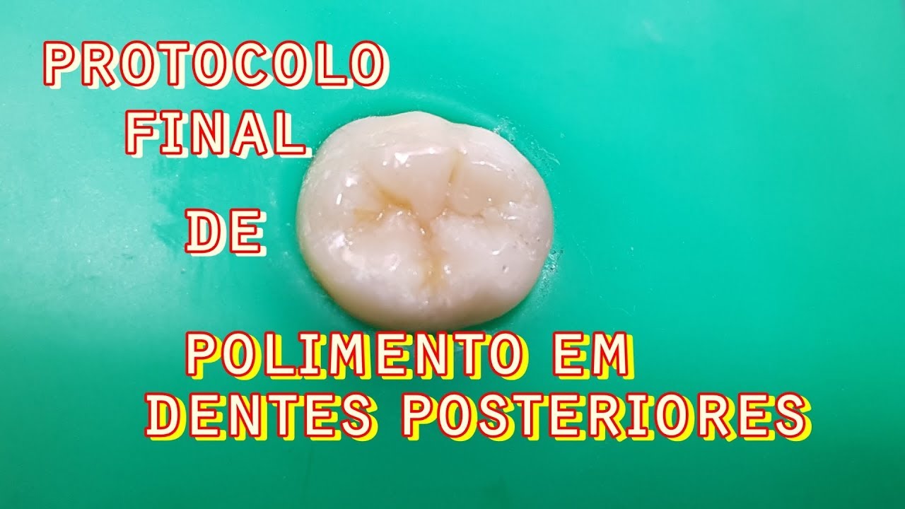 Watch Now 👉Protocolo Final de Polimento em 🛑Restaurações Posteriores 👉Protocolo Final de Polimento em 🛑Restaurações Posteriores