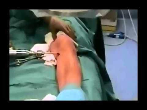 Oscillare avanti se il mal di schiena Perché durante mensile mal di schiena e laddome può essere