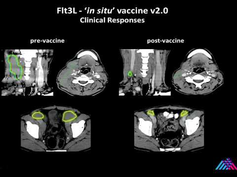 National CyTOF Meeting 2014: Josh Brody, MD, Icahn School of Medicine at Mount Sinai