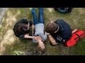 What To Do For Someone Having A Seizure Epilepsy