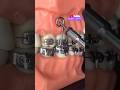 Dental BRACES ORTHODONTICS