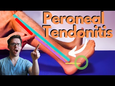 BEST 25 Plantar Fasciitis HOME Treatments Massage Stretches Shoes