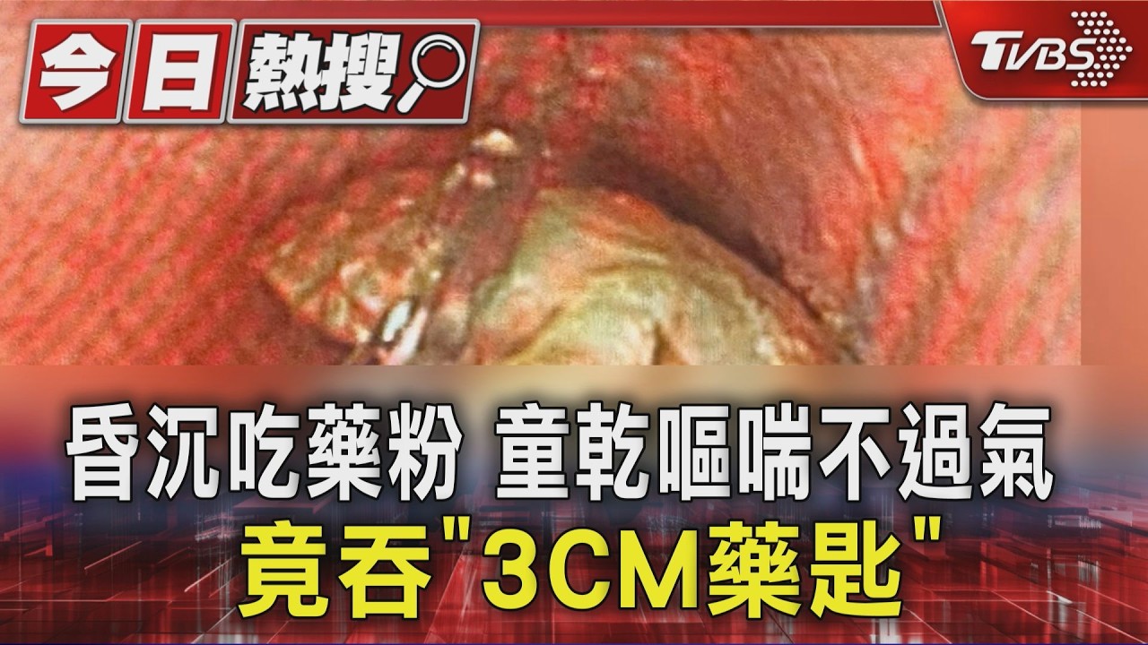 昏沉吃藥粉竟吞下藥匙！12歲童呼吸困難　醫示警感染風險