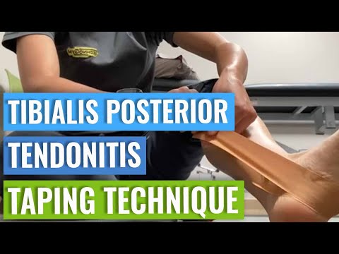 Taping For Posterior Tibial Tendonitis