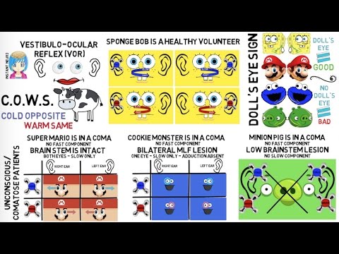 INSTANT NEURO - Nystagmus & VOR