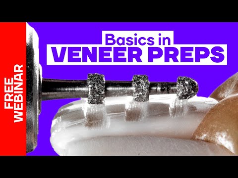 Basic Principles In Veneer Preps - Webinar