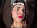 FILTER VS REALITY