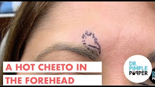 A Hot Cheeto In The Forehead! (With Sound!)