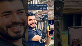 Bionic Hand Helps Man Regain Mobility After Electrocution