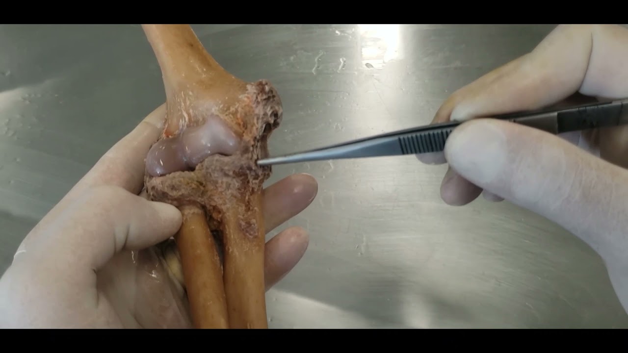 VÍDEO AULA PRÁTICA - LIGAMENTOS DE MEMBRO SUPERIOR