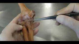 VÍDEO AULA PRÁTICA - LIGAMENTOS DE MEMBRO SUPERIOR
