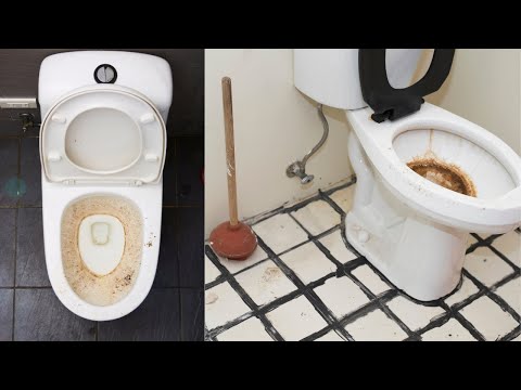image-How do you get rid of hard buildup in toilet?