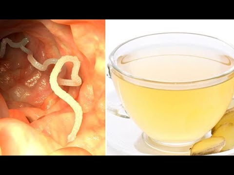 Il sospetto su parassiti che fare La prova su helminths in linea