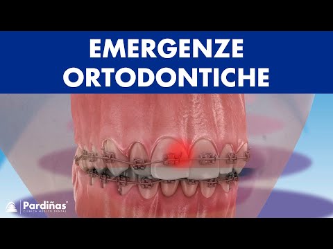 Come gestire le EMERGENZE ORTODONTICHE ©