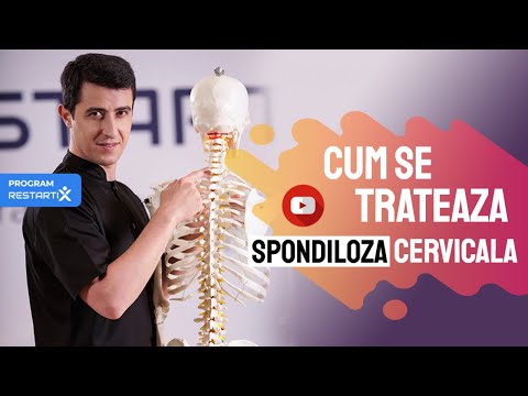 Remediu pentru osteocondroza cervicală