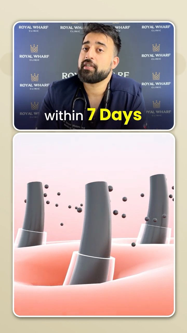 Baldness Finally Cured!? PP405