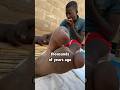 This African Tribe Has Only 2 Toes