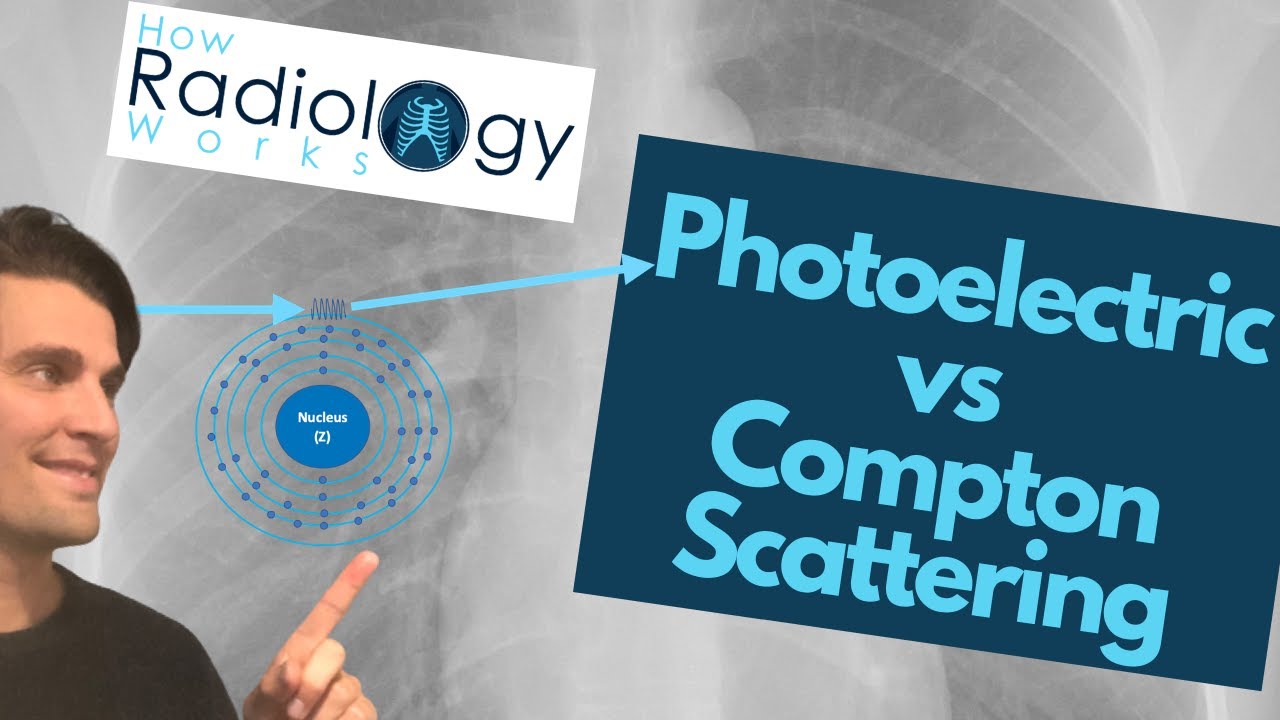X-ray Interactions Photoelectric and Compton Scattering for Radiologic Technologists [Rad Physics]
