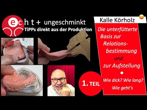 TEIL 1 - Unterfütterte Kunststoffbasen zur Optimierung der Relationsbestimmung und der Einprobe