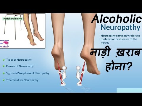 Signs You Might Have Neuropathy | Alcoholic'' Peripheral Neuropathy'' in Hindi By-Dr.Vishal PT Video