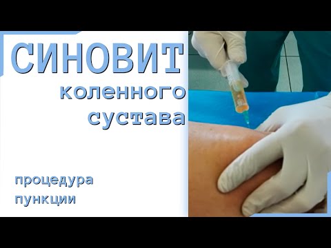 Кифоз шейного отдела позвоночника лечебная гимнастика Сколько стоит артропант мазь для суставов