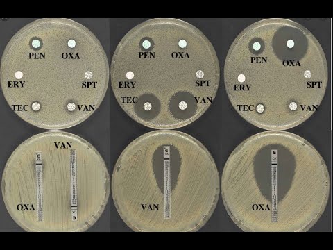 Disk diffusion assay: Kirby-Bauer Test