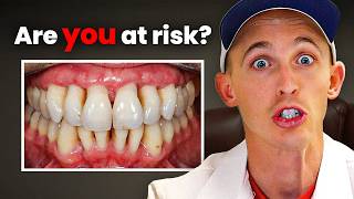 3 ways you WILL lose your teeth (even with good hygiene)