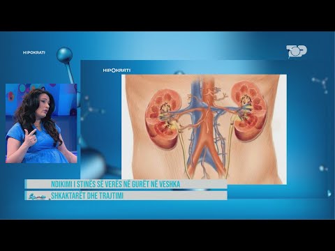 Stina e verës, sa ujë duhet të konsumoni? Gabimi që bëni më shpesh! - Hipokrati