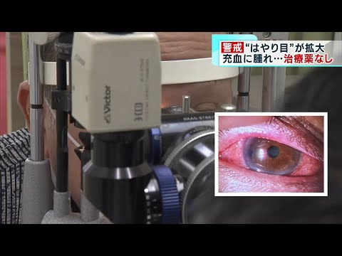 ウイルス性角結膜炎(職業病) - 定義