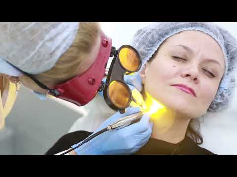 LASERSKO UKLANJANJE HIPERPIGMENTACIJE I OSTALIH PIGMENTNIH PROMJENA U POLIKLINICI ISTARSKO ZDRAVLJE