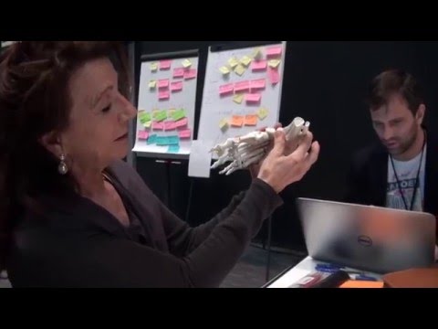 The Zurich Clubfoot Concept: An alternative to the treatment of the club foot