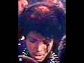 Michael Jackson S Head Is Really On Fire Pepsi Accident In 1984 Michaeljackson Shorts