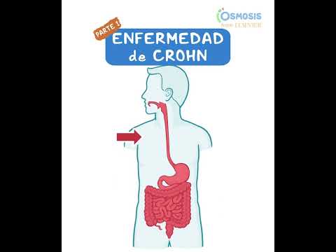 Diagnostics on Demand Cardiac tamponade