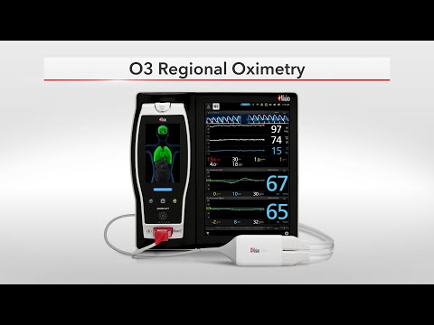 Masimo root with o3 regional oximetry