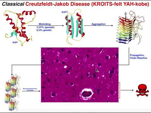 Prions | Mechanism of Classical Creutzfeldt-Jakob Disease (cCJD)