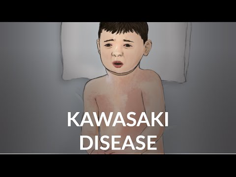 Maladie de Kawasaki
