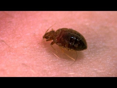 A Bedbug's Bite - Up Close! - Bang Goes the Theory - BBC