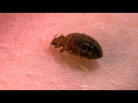 download lagu mp3 mp4 How To Sleep Knowing There Are Bed Bugs, download mp3 How To Sleep Knowing There Are Bed Bugs free download mp3, download mp3 How To Sleep Knowing There Are Bed Bugs