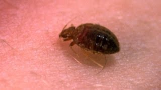 A Bedbug&#39;s Bite - Up Close! - Bang Goes the Theory - BBC