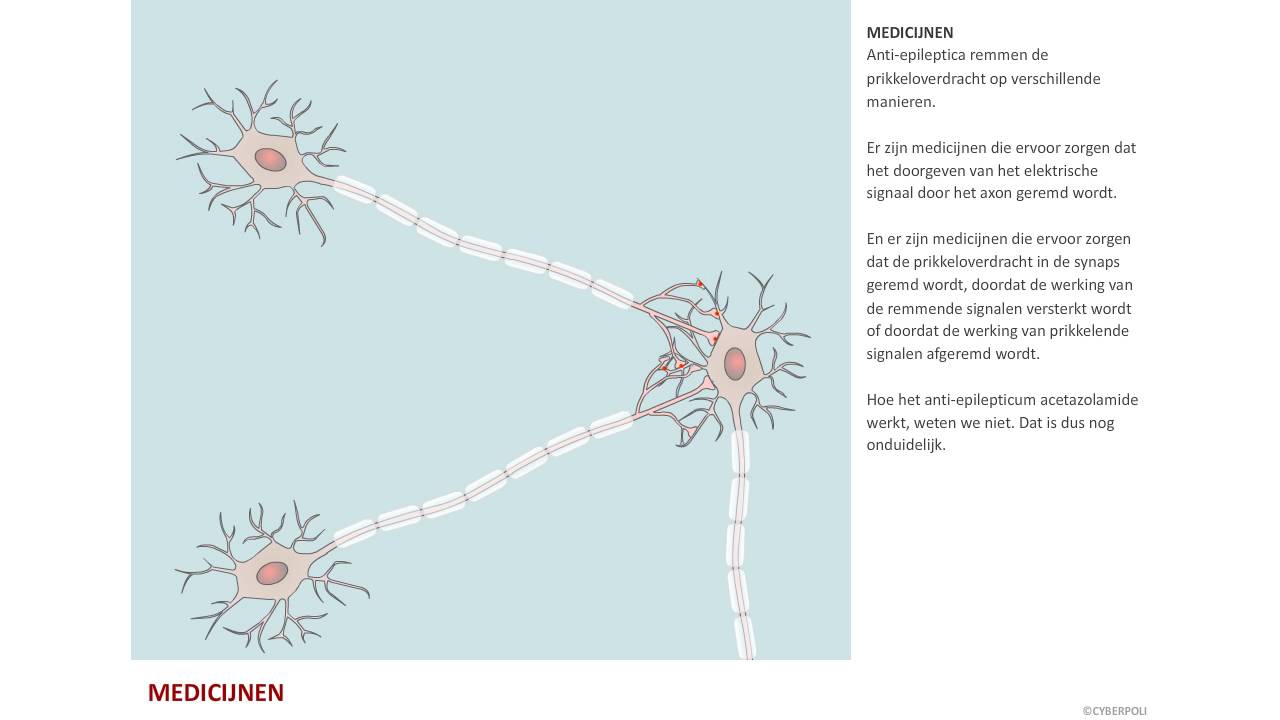 klassiek ontwerp Woedend Epilepsie - Behandeling epilepsie | Cyberpoli