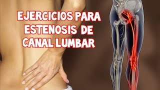Ejercicios para ESTENOSIS DE CANAL LUMBAR