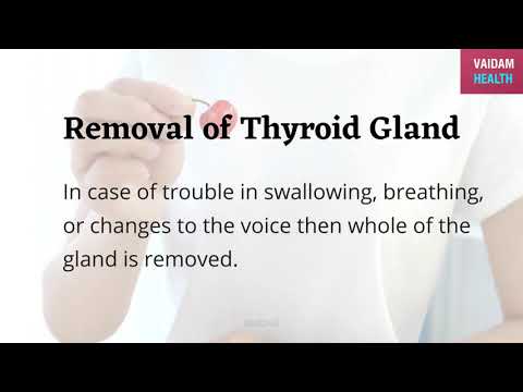 Complete Thyroidectomy- 8 Frequently Asked Questions